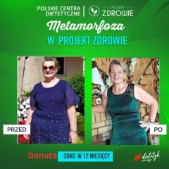 Niesamowita metamorfoza - Pani Danuta schudła 30 kg w&nbsp;Gabinecie Projekt Zdrowie!