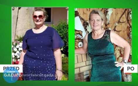 Niesamowita metamorfoza - Pani Danuta schudła 30 kg w&nbsp;Gabinecie Projekt Zdrowie!